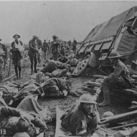 Wounded soldiers near a damaged military vehicle, 1917